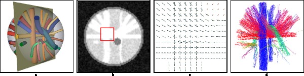 Digital phantom in diffusion MRI